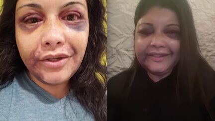 Vanessa Tijerina after hotel attack