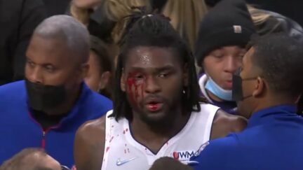 Isaiah Stewart bloodied by LeBron James elbow