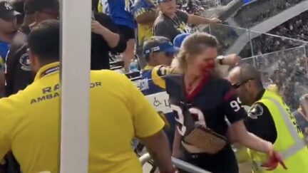Texans fan left bloodied after brawl
