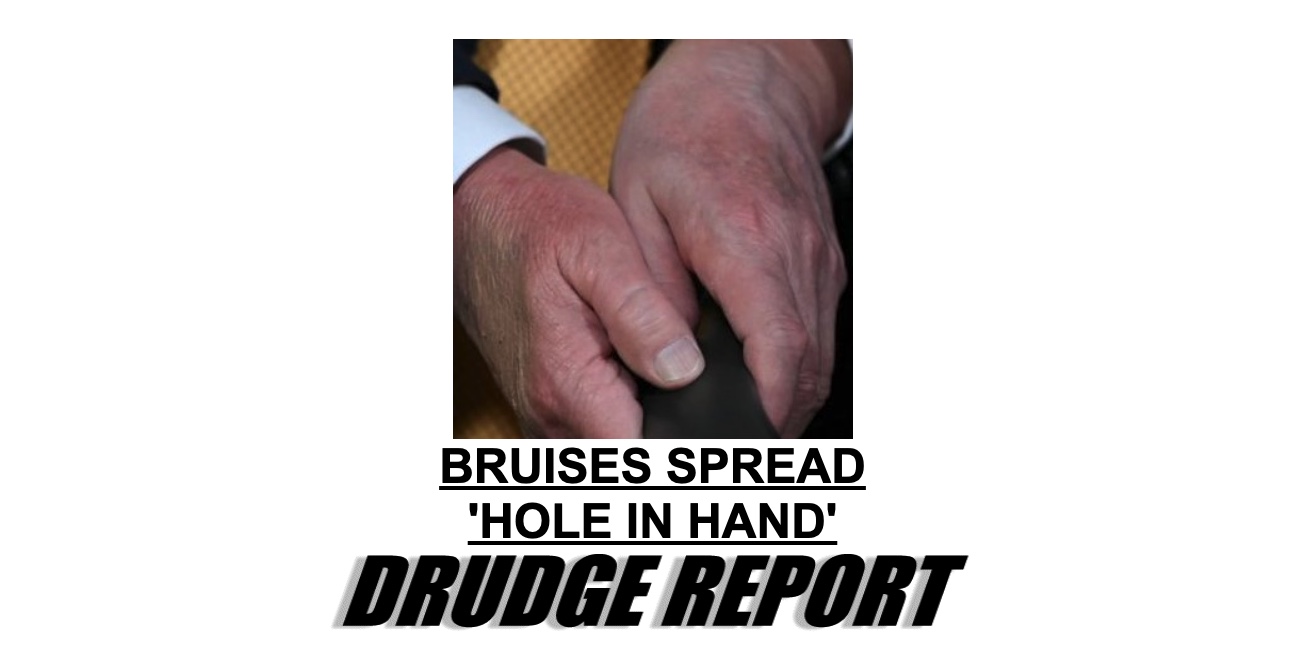 Trump hands